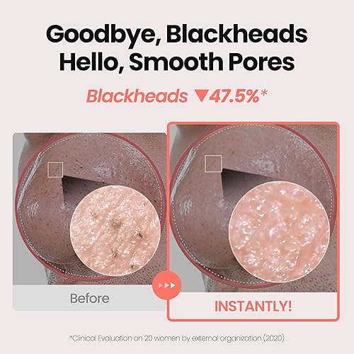 Miniatura 4 de K-Beauty Aceite de vitamina de rosa para espuma, limpiador facial coreano todo en uno a base de aceite, minimizador de poros y removedor de puntos
