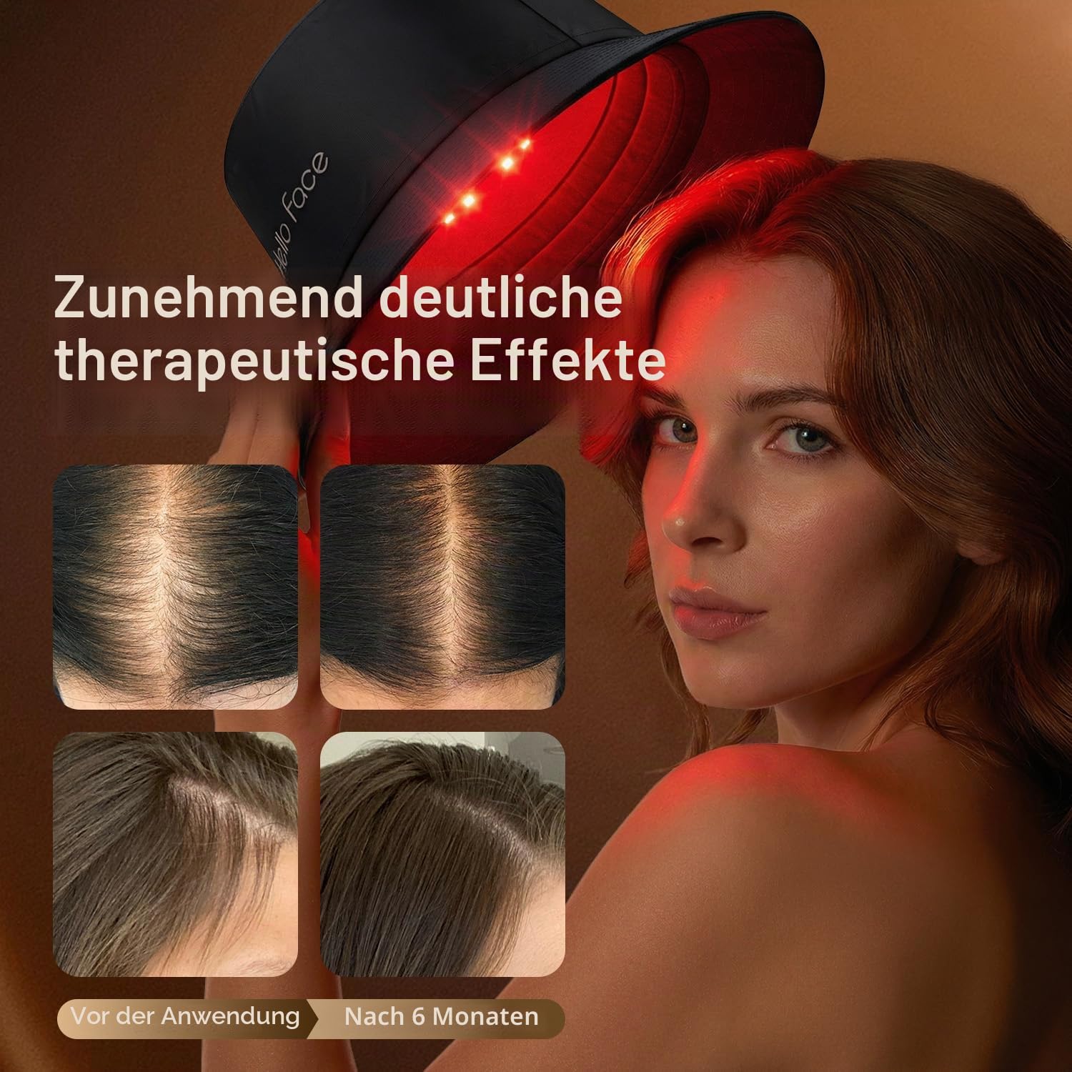 Rotlicht therapie Hut für Haarwachstum Beschleunigen, 336 LEDs 660nm & 850nm Infrarotlicht, Modisches Fischerhut-Design bis 62 cm, Professionelle Lichtpflege für gesunde Kopfhaut