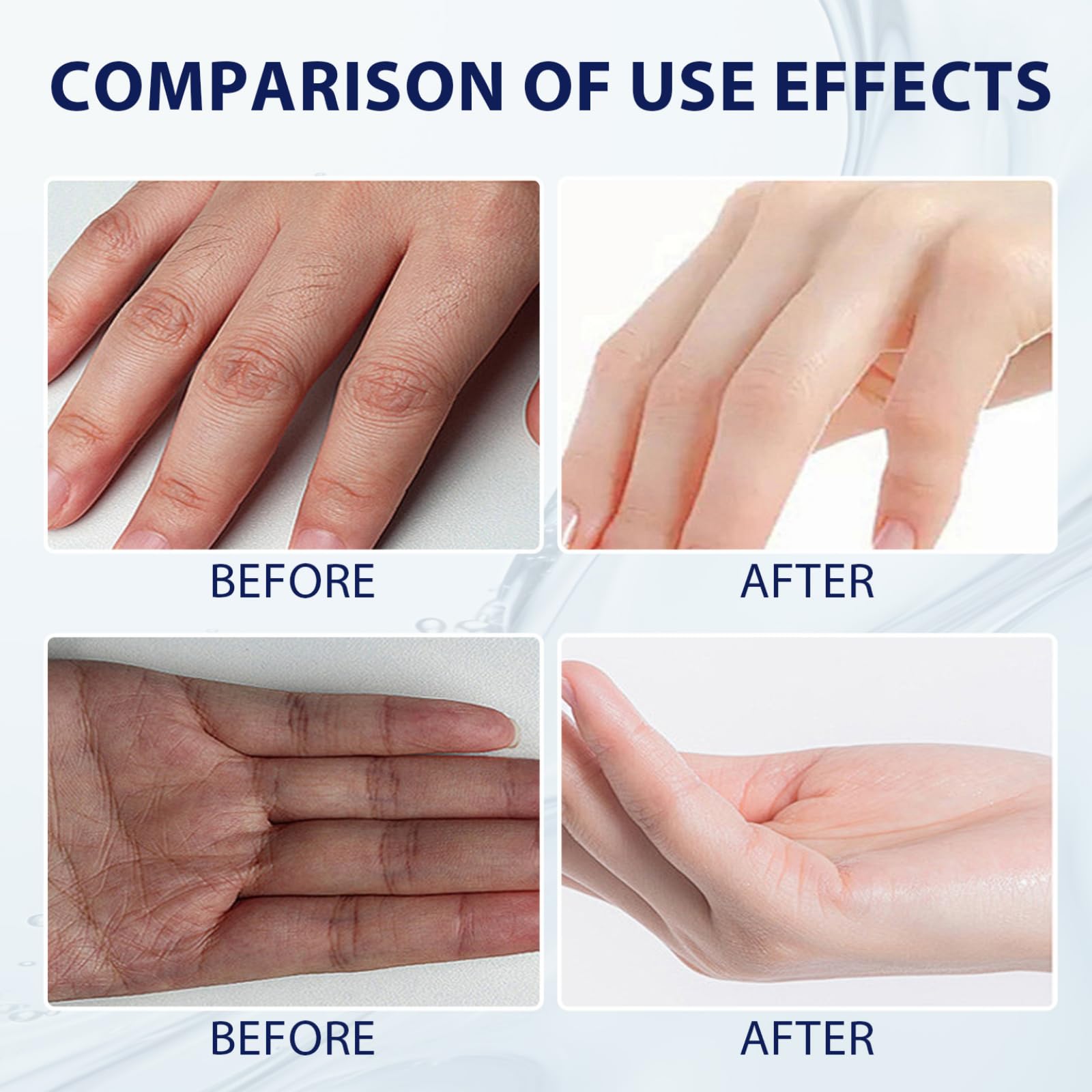 100 ml Aloe Vera Hand Cream - Gentle Hand Cream For Very Dry Hands, Hand Moisturiser With Natural Aloe & Vitamin E, Hands Gel For Sensitive Skin, Aloe Vera Gel For Skin Care, Hand Cream For Women - Image 4