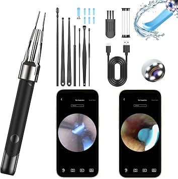Ear Wax Removal Tool Camera | 2-in-1 Scoop & Tweezer, 5.0MP HD Otoscope | FDA-Registered WiFi Ear Cleaner with 6 LED Lights, Complete Kit for iPhone & Android