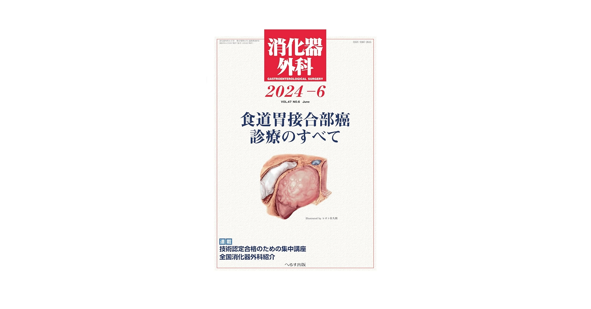 2冊セット 食道・胃ＥＳＤ　改訂版 消化器内視鏡ＤＶＤ付 食道癌診療ガイドライン 2冊セット 食道・胃ESD 改訂版 消化器内視鏡DVD付 食道