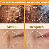 Vista 7 de NuDerma - Máquina portátil de terapia de piel de mano, con neón, antienvejecimiento, estiramiento de la piel, reducción de arrugas, círculos