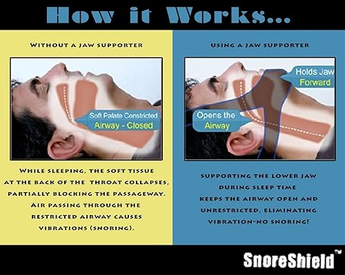 Miniatura 2 de SnoreShield - Correa antironquidos para la barbilla, la solución de sueño para ronquidos número 1, tapón instantáneo natural y cómodo, fácil de usar