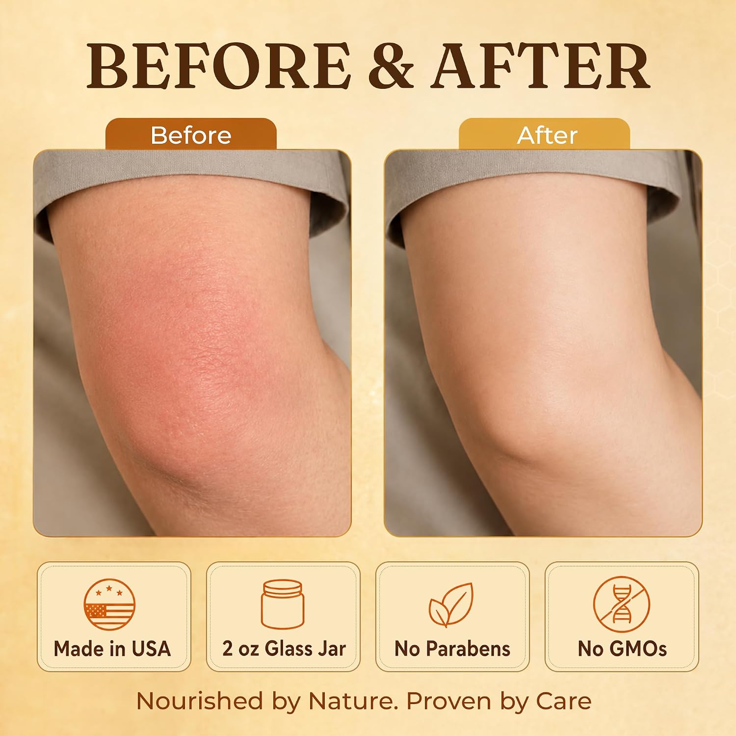ProSeed Manuka Honey Tallow Balm for Face & Body Butter, Skin Care 2 oz. image 5