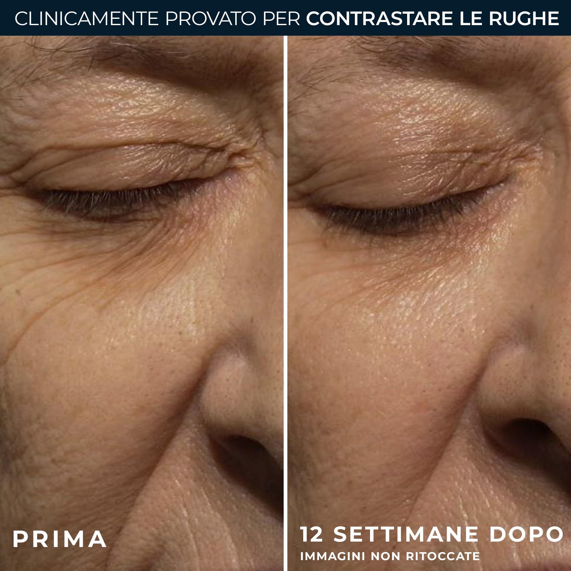 RoC Retinol Correxion Wrinkle Correct Crema Notta Antirughe Antietà Idratante Viso Retinolo Complesso Minerale 30 ml