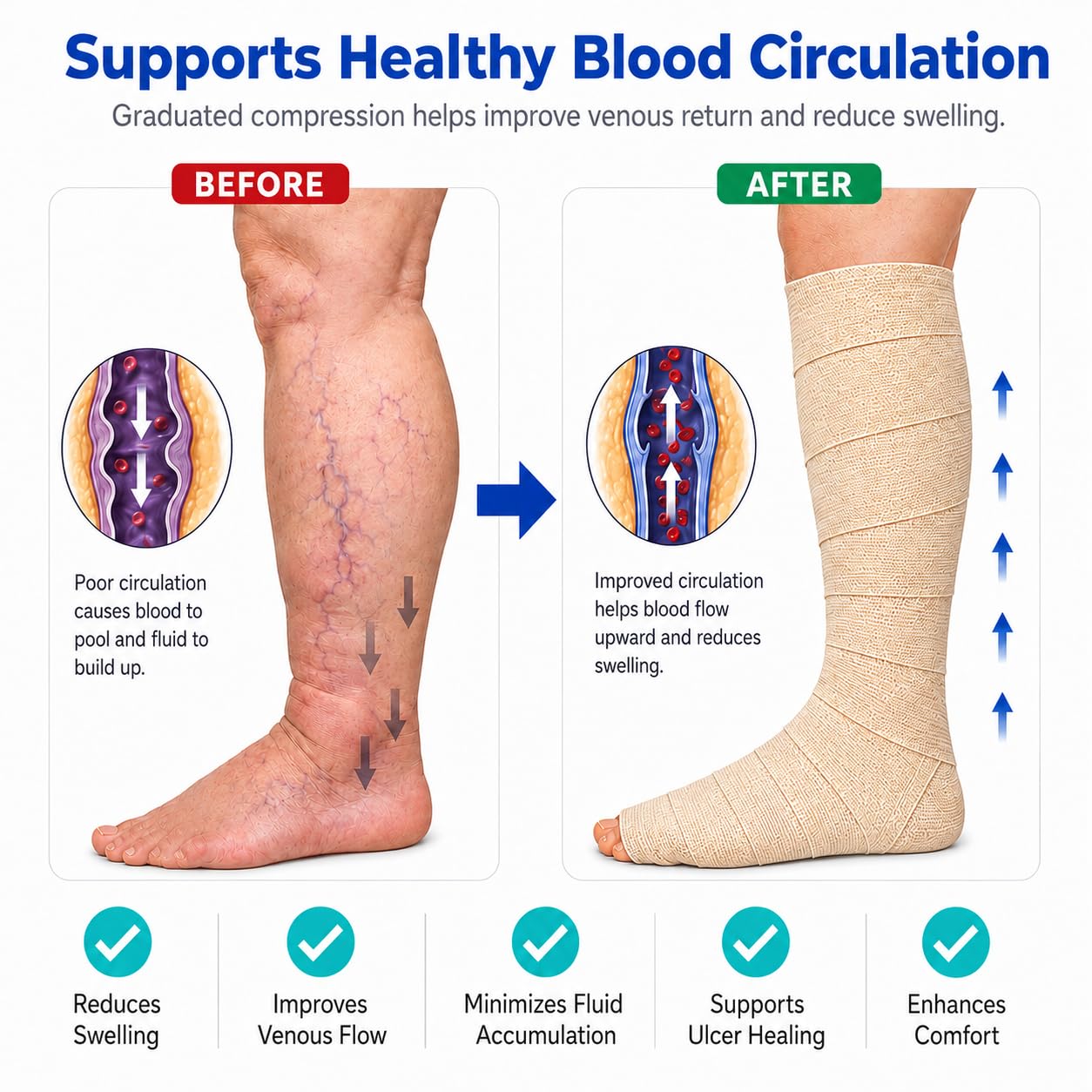 Vein Care 4-Layer Compression Bandage for Venous Leg Ulcers — Amazon image 3