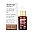 Sesderma AZELAC RU Liposomal Facial Serum 1.0 fl. Oz for Sun Spots, Age Spots and Hyperpigmentation