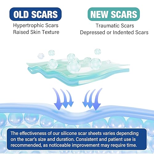 Miniatura 5 de Silicone Scar Sheets,Silicone Scar Tape(1.6"x 158" Roll-4 meters),Silicone Scar Sheets for Surgical Scars,Keloid Bump Removal,Scar Tape for