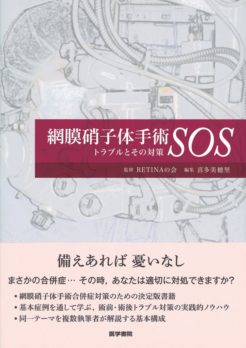 Amazon.co.jp: 網膜硝子体手術SOS―トラブルとその対策 : RETINA