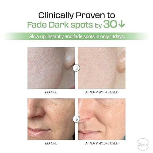 Miniatura 3 de JUMISO All Day Vitamin Pure C 5.5 Glow Serum - L-ácido ascórbico alfa-arbutina aronia extracto mejora la pigmentación hiperpigmentación - Cuidado de