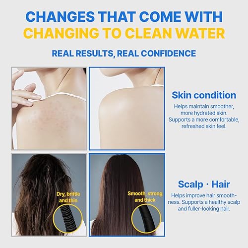 Miniatura 9 de Filtro de ducha para el cuidado de la piel K-Beauty filtros de carbono puro para una piel más suave y un cabello más suave  Filtro compuesto de