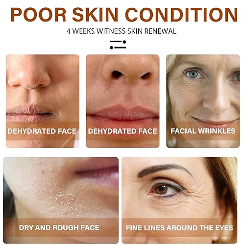 Miniatura 6 de Suero de retinol para cara con ácido hialurónico, vitamina E antienvejecimiento y suero facial de retinol, suero reafirmante de retinol para la cara