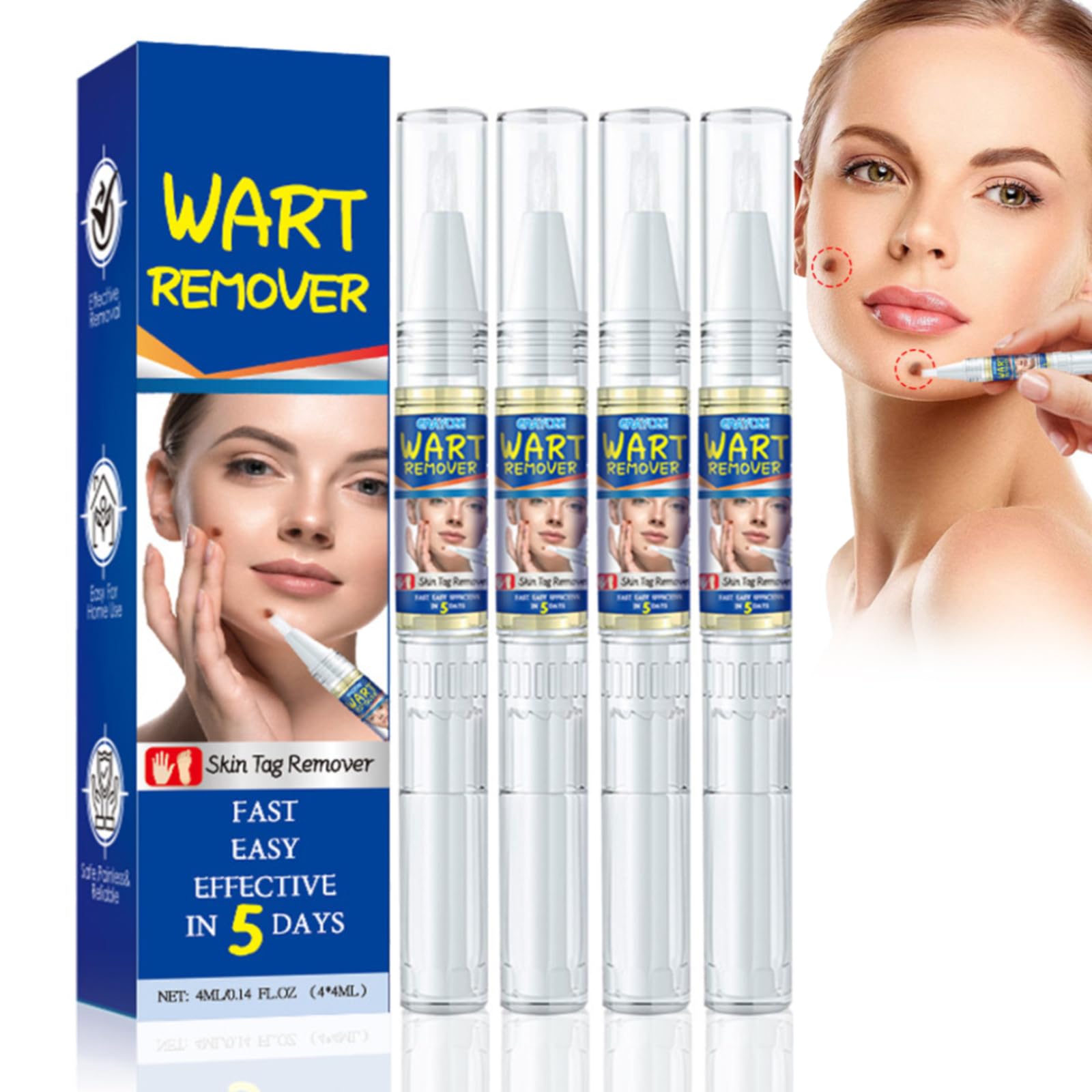 JORUN 4 Pack Skin Tag Removal Kit - Fast Effective Wart Remover Pen for Hands,Feet,Face,Body,Men,Women - Wart Removal Natural & Safe for All Skin Types（4ml * 4）
