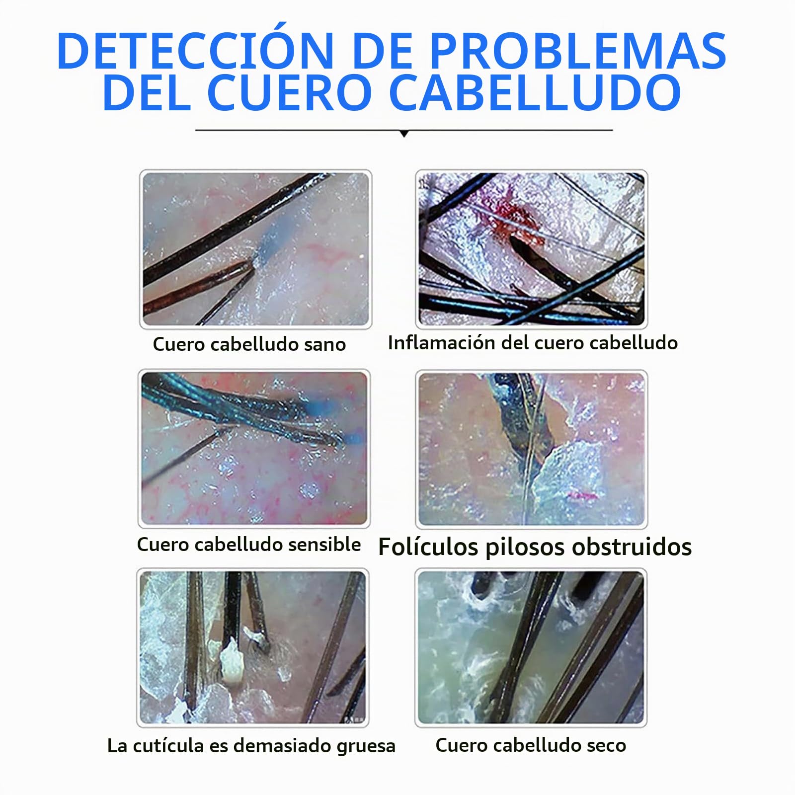 Máquina de análisis de cuero cabelludo inalámbrico, probador de analizador de piel, analizador de cabello de piel, detector de folículos pilosos de la piel multifunción, 3 engranajes, 1 megapíxeles, p