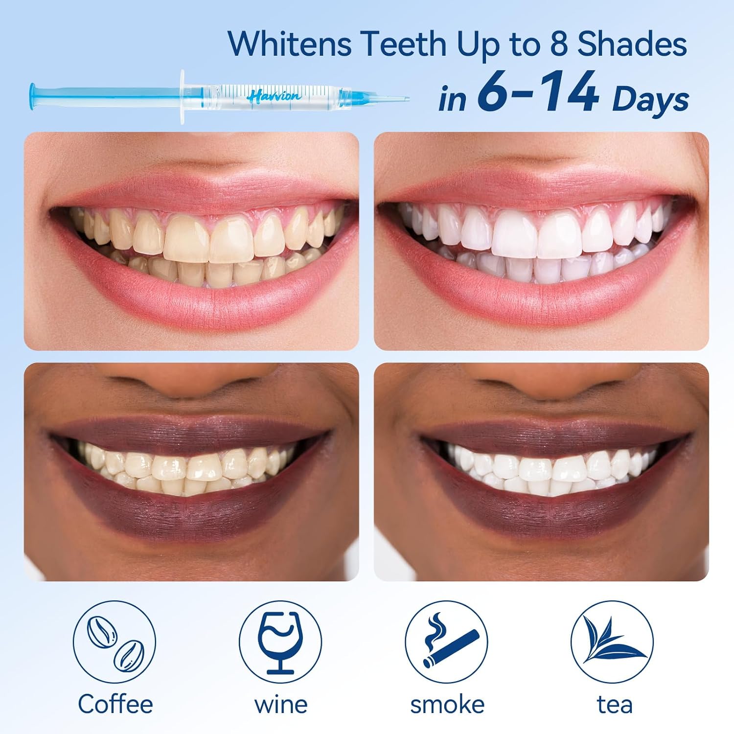 35% Carbamide Peroxide Teeth Whitening Gel, No Sensitive Teeth Whitener