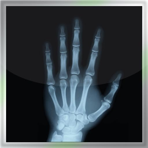 Real X-Ray Scan