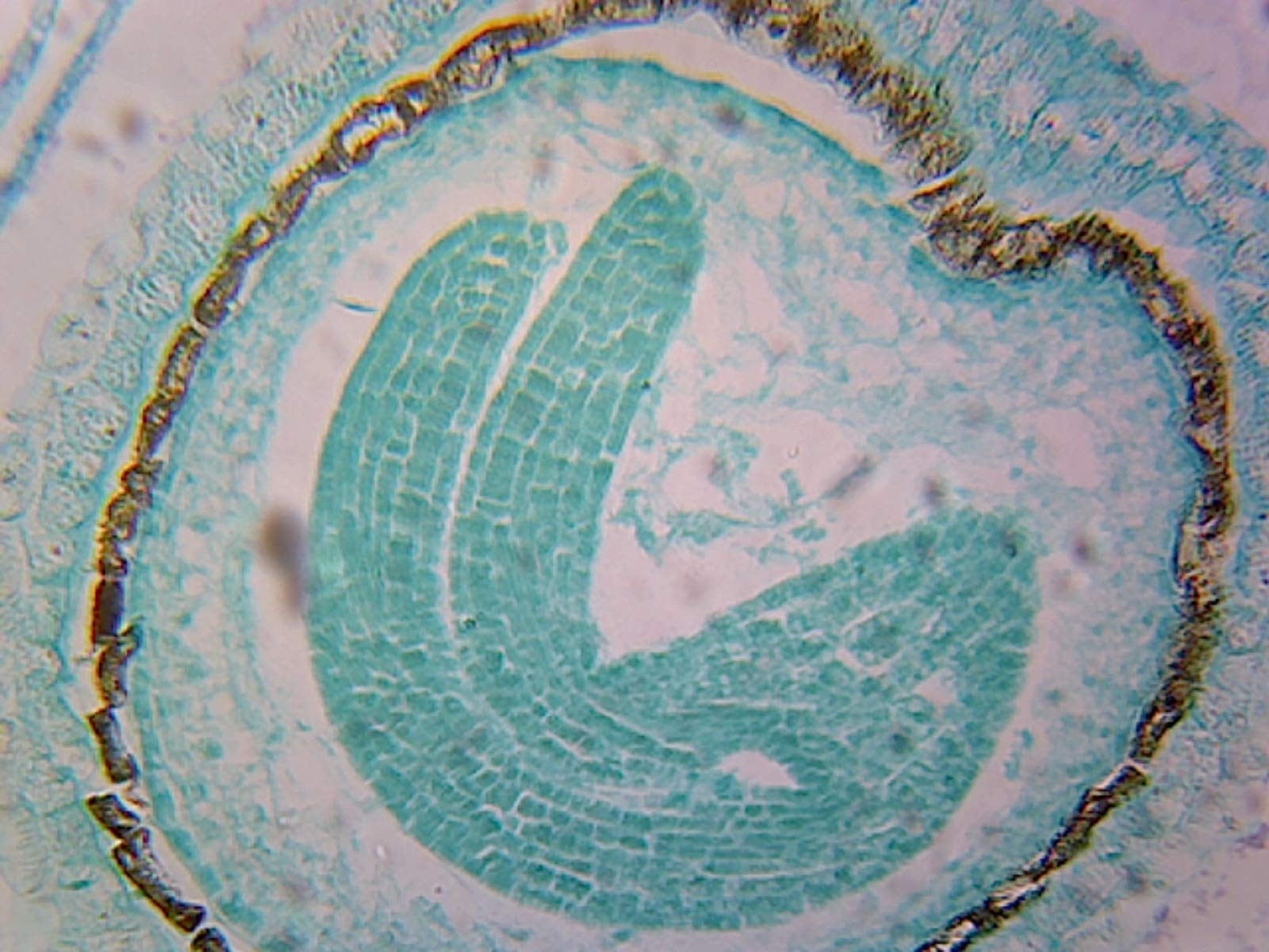 Capsella Embryo Later Cotyledon Stage - Microscope Slide