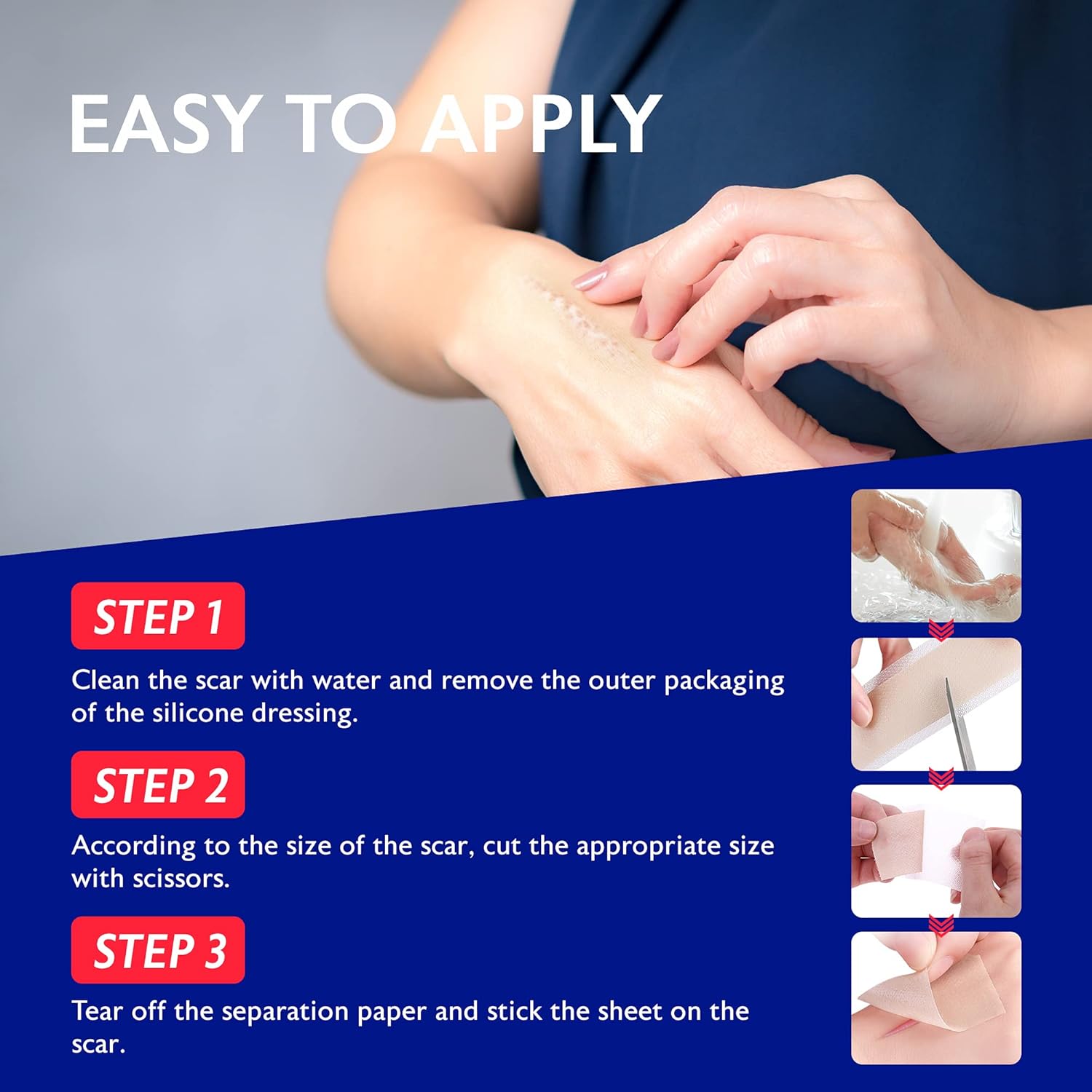 Beautivity Advanced Scar Removal Silicone Tape for Hypertrophic Scars and Keloids Caused by Surgery, Injury, Burns, C-Section and More, 1 Roll, 1.6” x 60” : Everything Else