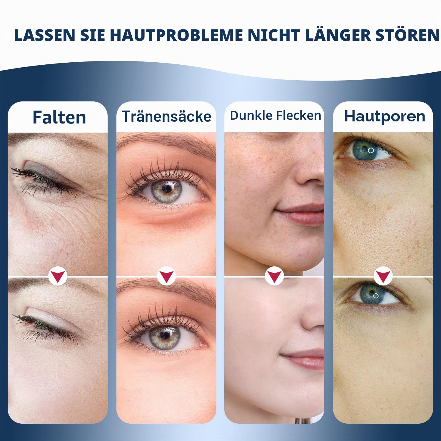 Pulsierendes Hausgeräte-Beauty-Gerät,Fortschrittliches Radiofrequenzgerät für das Gesicht mit Puls-Radiofrequenztechnologie, Mikroströmen, Faltenreduzierung, Gesichtspflege.