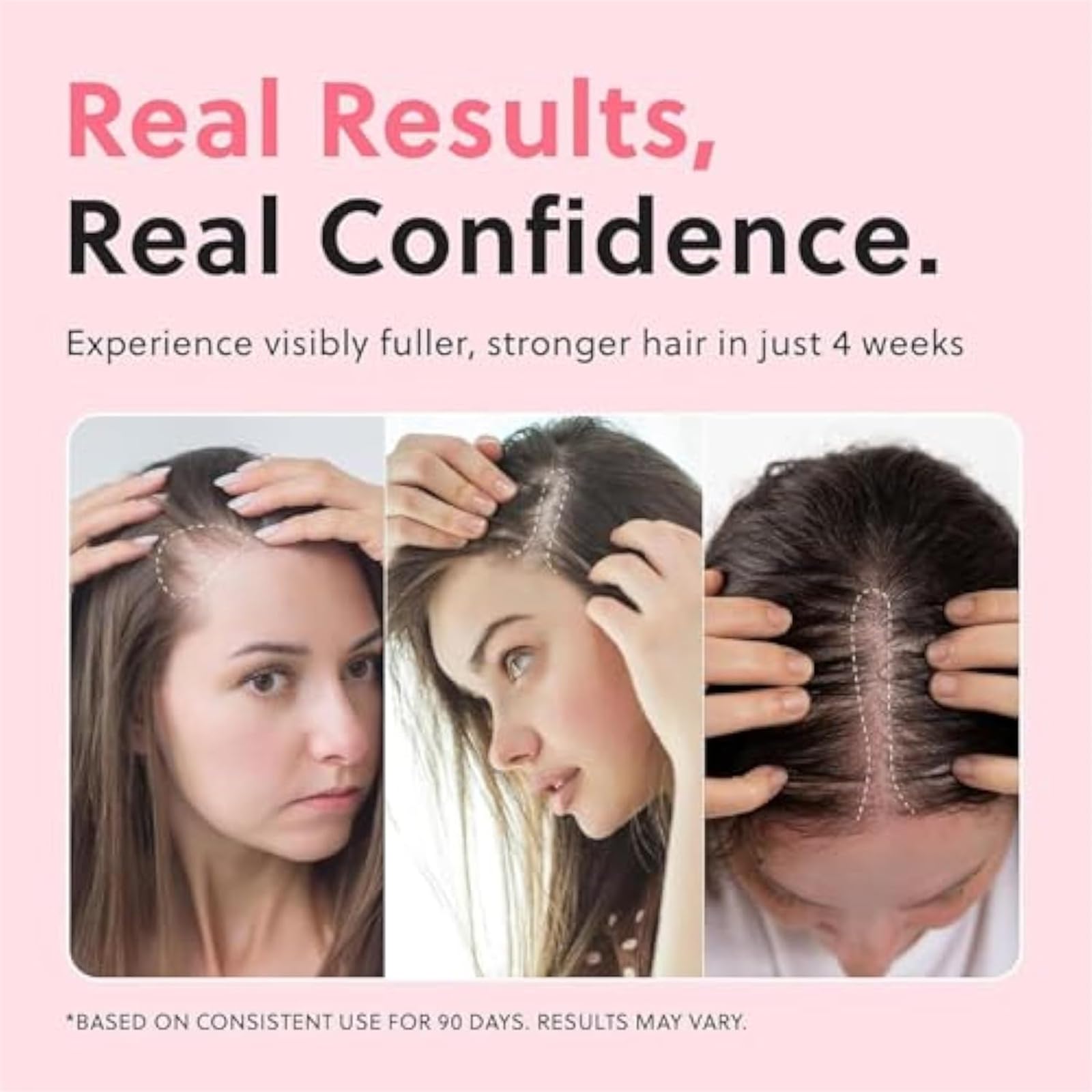 Aceite de Crecimiento Natural Avanzado para el Cabello No Grasiento - Fortalecedor y Engrosamiento del Cabello, Nutritivo para el Cuero Cabelludo (3pcs)