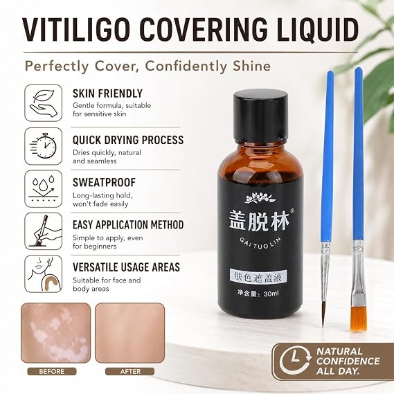 30ml Vitiligo Covering Liquid Concealer Dropper for Face and Body Skin Friendly Makeup White Spot Concealer for Vitiligo Skin Camouflage