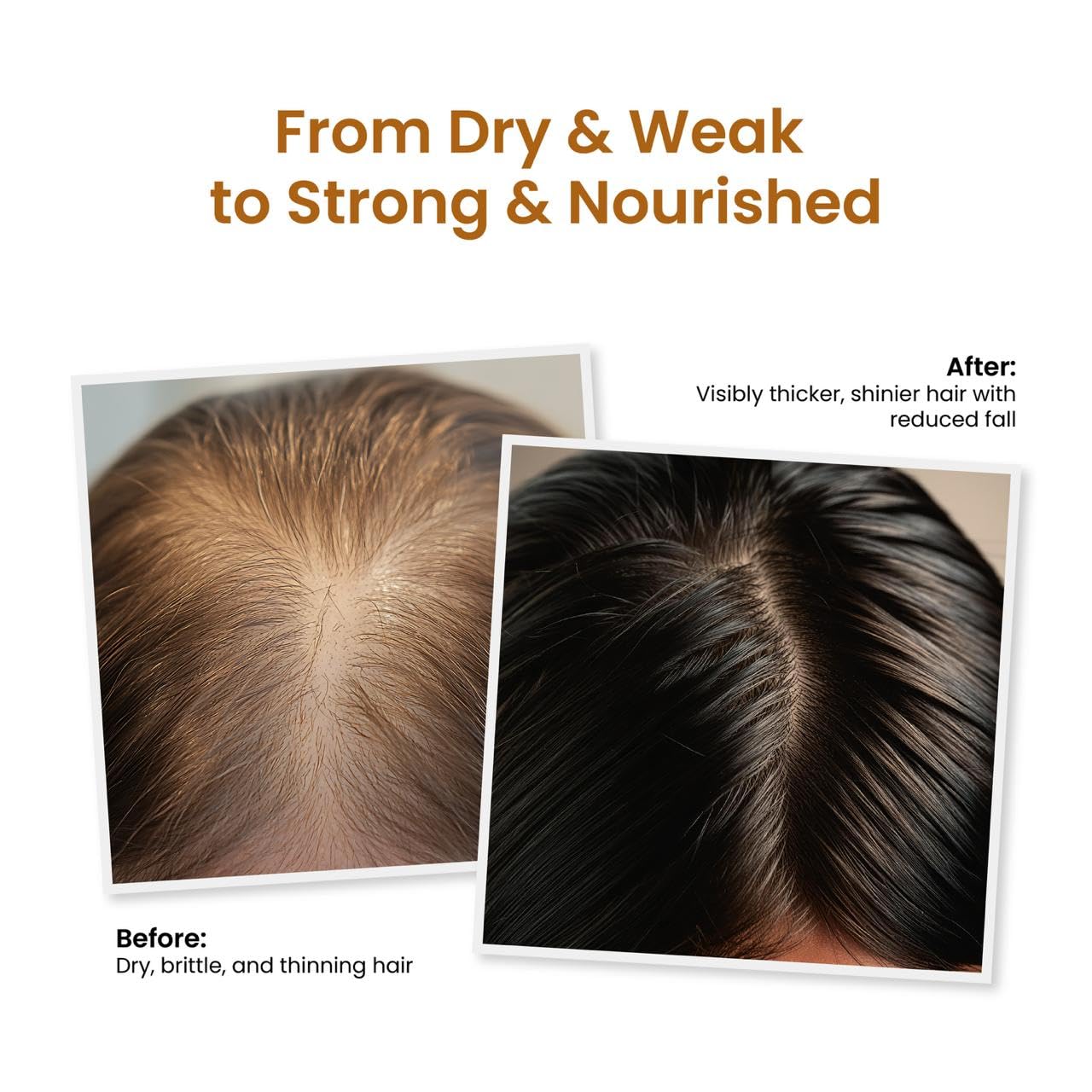 Trycone Rosemary Hair Oil for Hair Growth & Scalp Health β Enriched with Herbs & Vitamin E | Reduces Hair Fall, Strengthens Roots, Promotes Shine | 200 ml 1