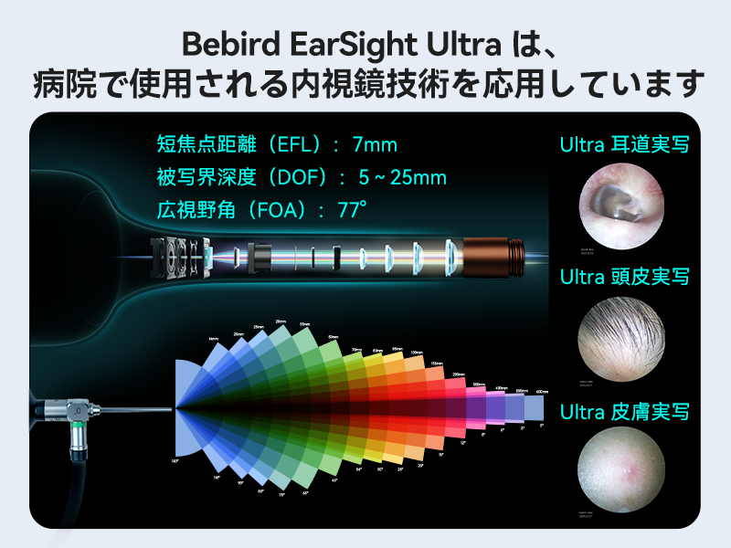 Amazon.co.jp: Bebird Earsight Ultra｜2026年最上級モデル｜新世代