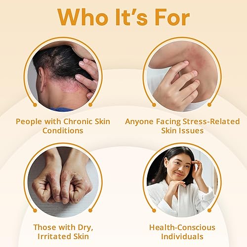 Miniatura 7 de Suplemento de psoriaskin Strength & Spices, refuerzo del sistema inmunológico con 31 ingredientes potentes y aminoácidos, alivia la piel roja,