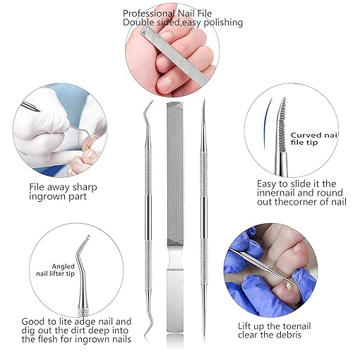 Miniatura 4 de HOTACE Kit de herramientas encarnadas para uñas de los pies (11 unidades) para uñas de uñas de uñas encarnadas de acero inoxidable para uñas de pies