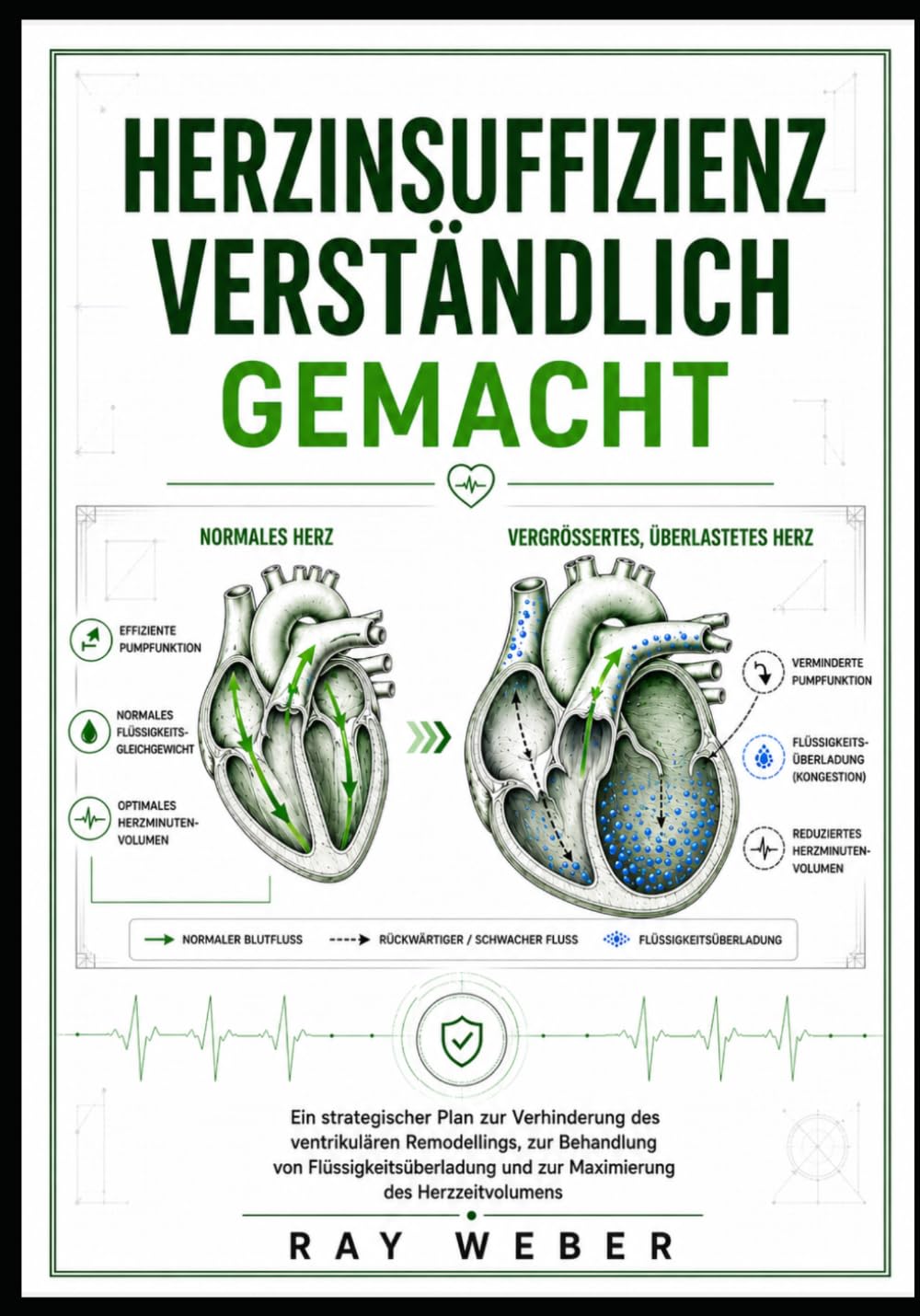 Herzinsuffizienz verständlich gemacht: Ein strategischer Plan zur Verhinderung des ventrikulären Remodellings, zur Behandlung von ... dein Herz. Schütze dein Herz. Lebe länger.)