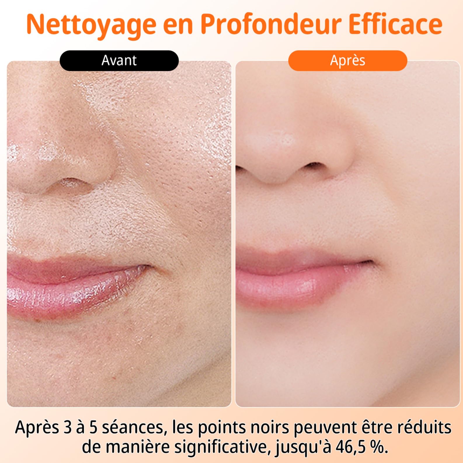 Aspirateur Pour Points Noirs, Extracteur Points Noirs Visage, 3 Modi Rechargeable & 6 Sondes & Réservoir d'eau Visible pour le Nettoyage du Visage, Traitement de l'acné et Soins de la Peau - Blanc