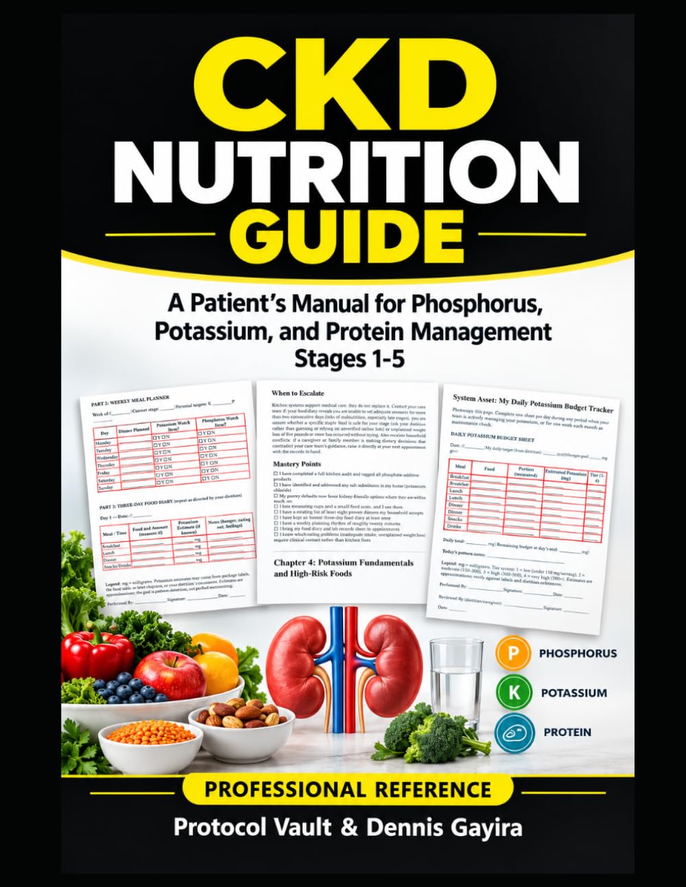 CKD NUTRITION GUIDE: A Patient's Manual for Phosphorus, Potassium, and Protein Management Stages 1-5