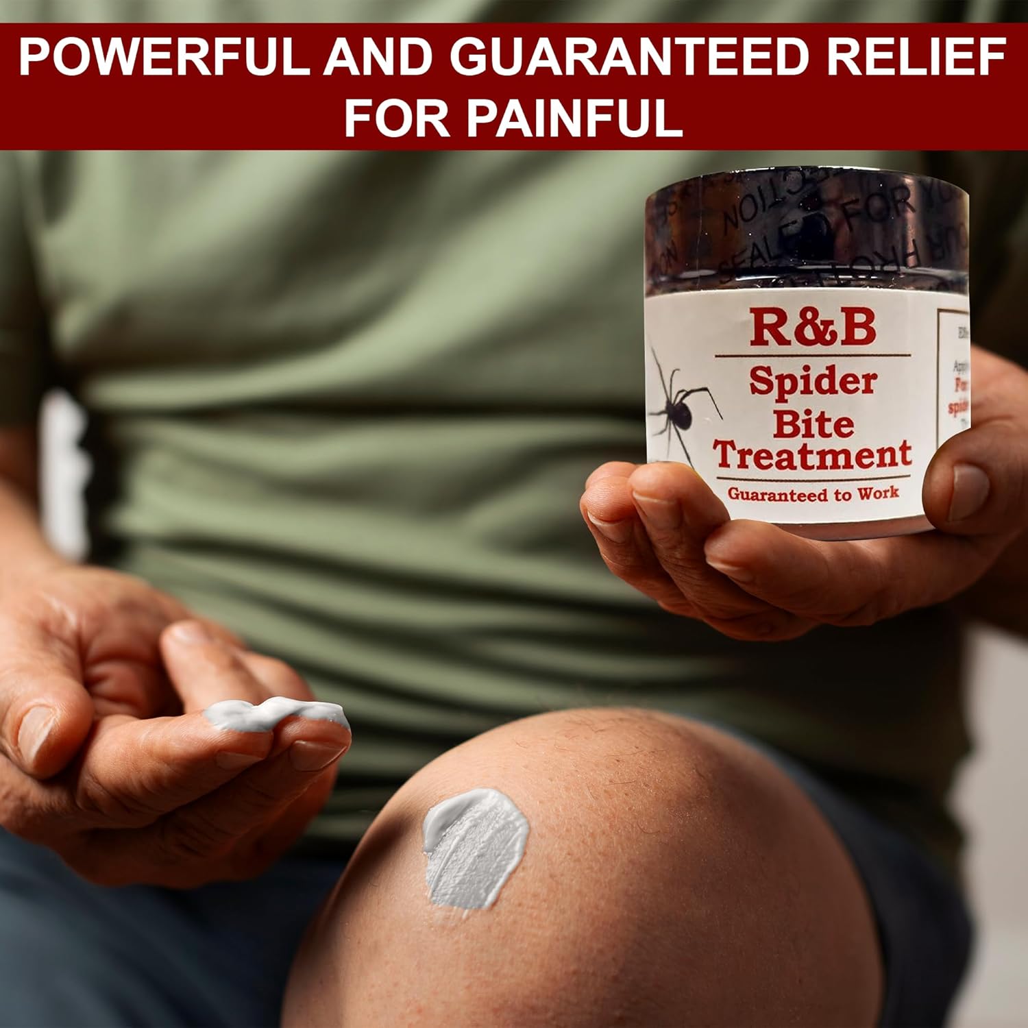 R&B Natural Spider Bite Treatment Effective for Brown Recluse, Black Widow, and Other Insect Bites | 3oz Balm