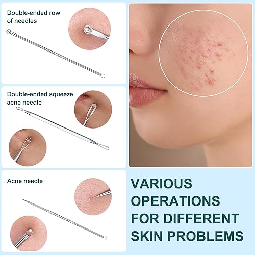 Miniatura 6 de Extractor de puntos negros, 3 piezas, herramienta para reventar espinillas, herramienta extractora de comedones para acné y manchas de espinillas,