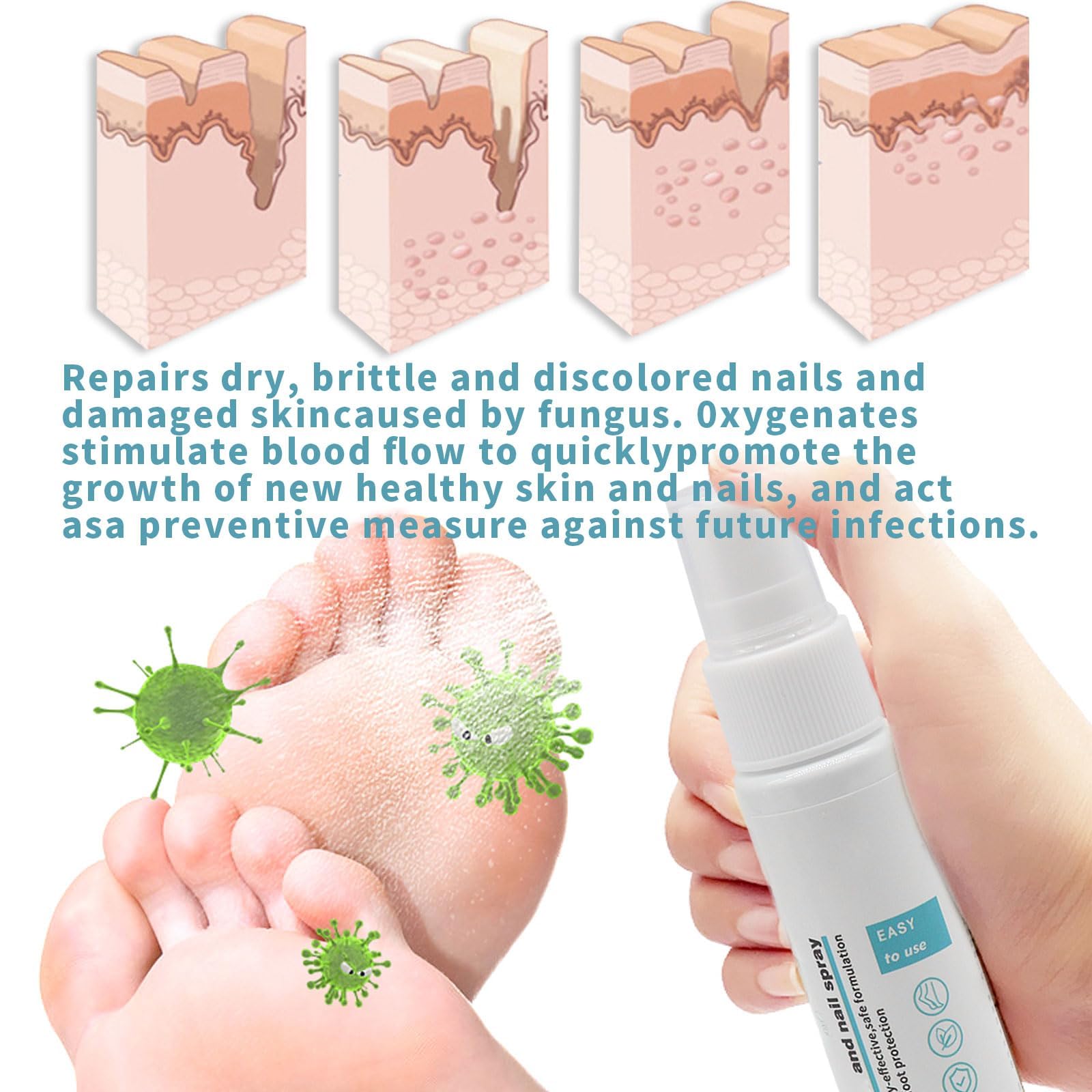 Spray para Hongos en Los Pies, 2 unidades para Pies y Uñas, Spray para Hongos en Las Uñas, Spray para Pies para Reparación de Uñas, control de olores, aerosol de pies para reparación de uñas