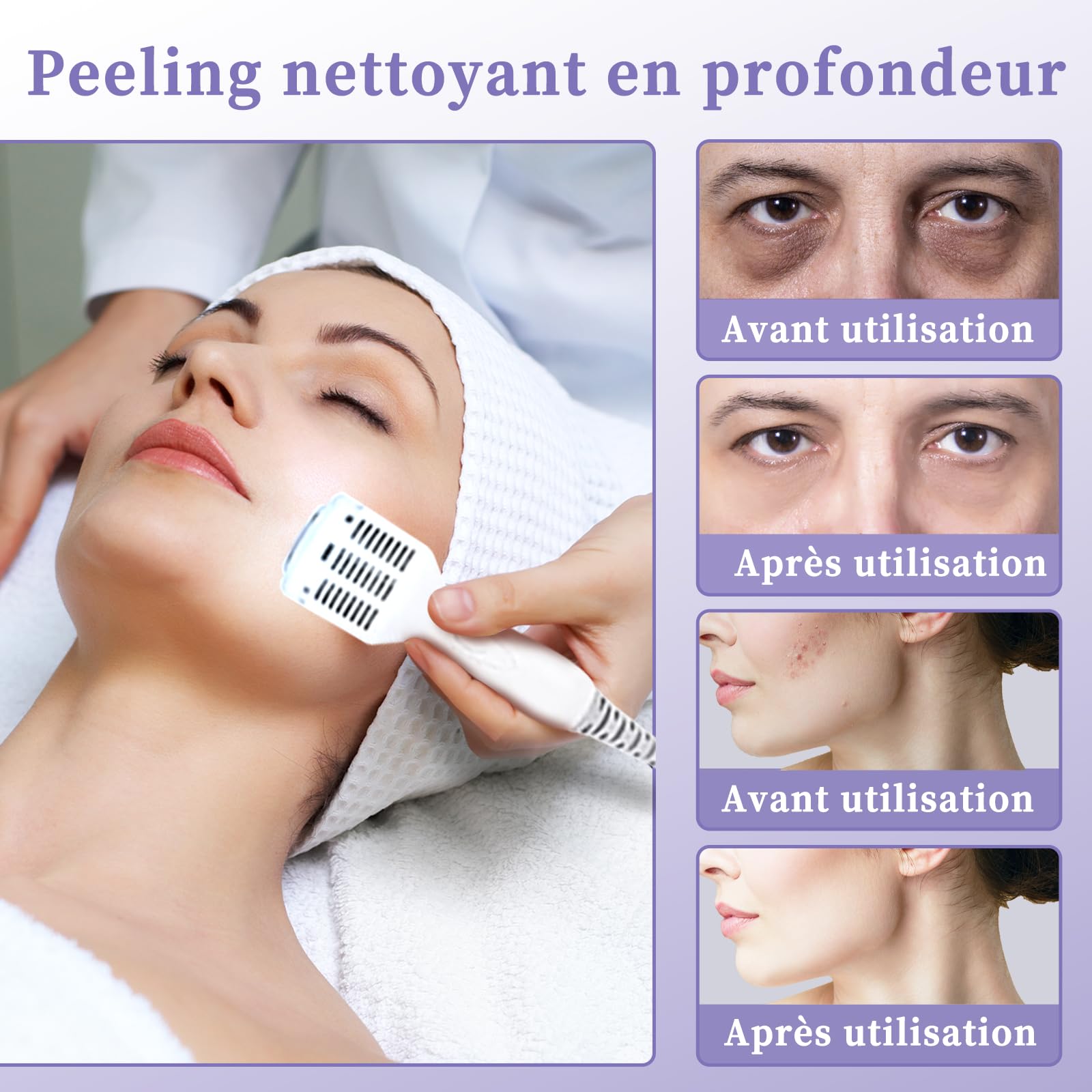 Hydrafacial 7 En 1 Machine à Oxygène à Hydrafacial Profession Nettoyage En Profondeur Microdermabrasion Exfoliante Petit Appareil De Beauté à Bulles éliminer Les Rides Dermabrasion