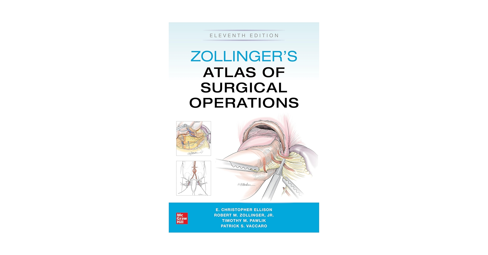 Zollinger's Atlas of Surgical Operations, Eleventh Edition