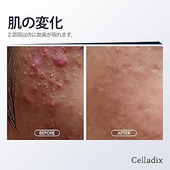 Amazon | Celladix(セラディックス) セバム リバランシング RX