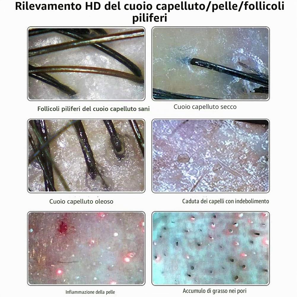 11 "Rilevatore del cuoio capelluto dei capelli della pelle del microscopio digitale dell'analizzatore della pelle Tester dei capelli per la cura dei capelli della pelle