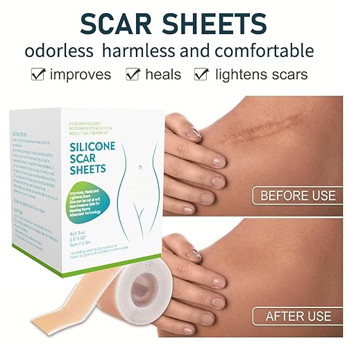 Miniatura 4 de Cinta de silicona de grado médico para cicatrices (rollo de 1.6 x 59 pulgadas, 4.9 ft), hojas de cicatrices de silicona para cesáreas, cirugía,