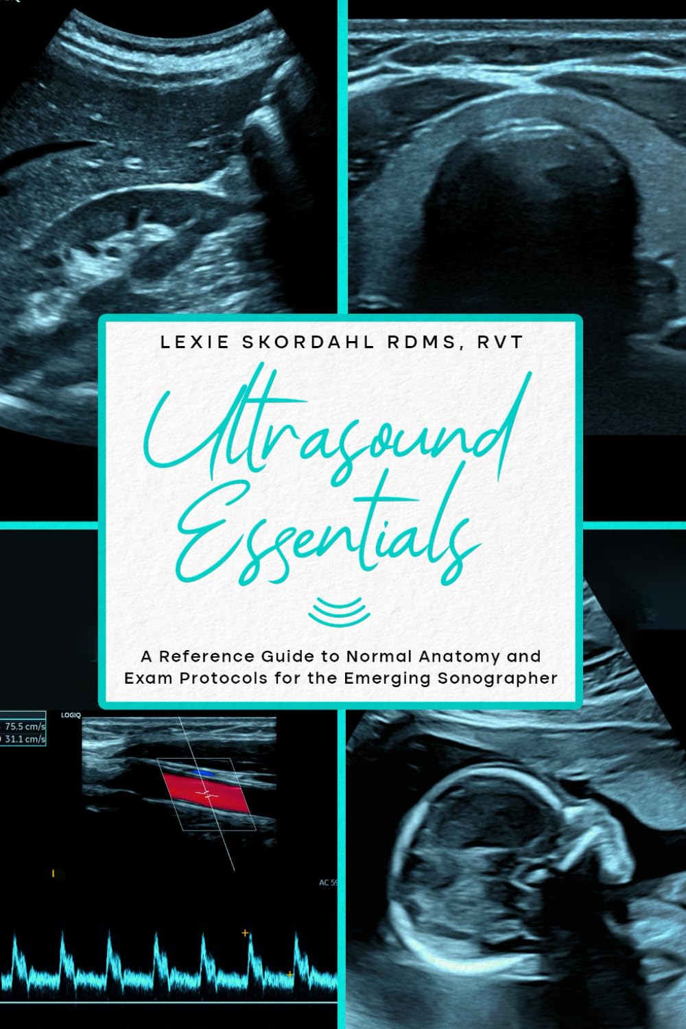 Ultrasound Essentials: A Reference Guide to Normal Anatomy and Exam Protocols for the Emerging Sonographer