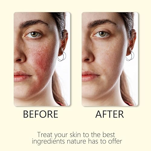 Miniatura 5 de Cebo de Res para la Cara Original, Sebo de Res para la Cara, Bálsamo de Sebo de Vacuno Ecológico Alimentado con Pasto para una Piel Tersa Hidratante