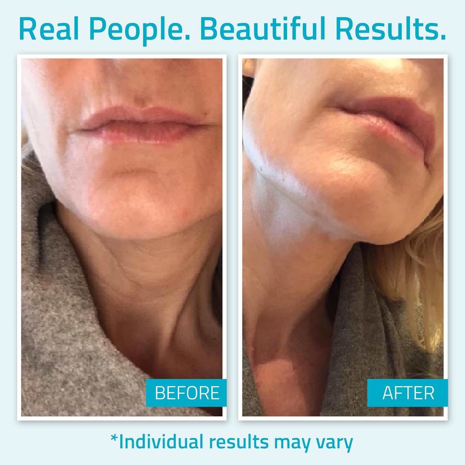 YEOUTH Day Night Face Moisturizer with Hyaluronic Acid, Snail Mucin Cream and Copper Tripeptide, Hydrating Fragrance Free Facial Moisturizer, Face Skin Care Cream for Women and Men 4oz - Image 4