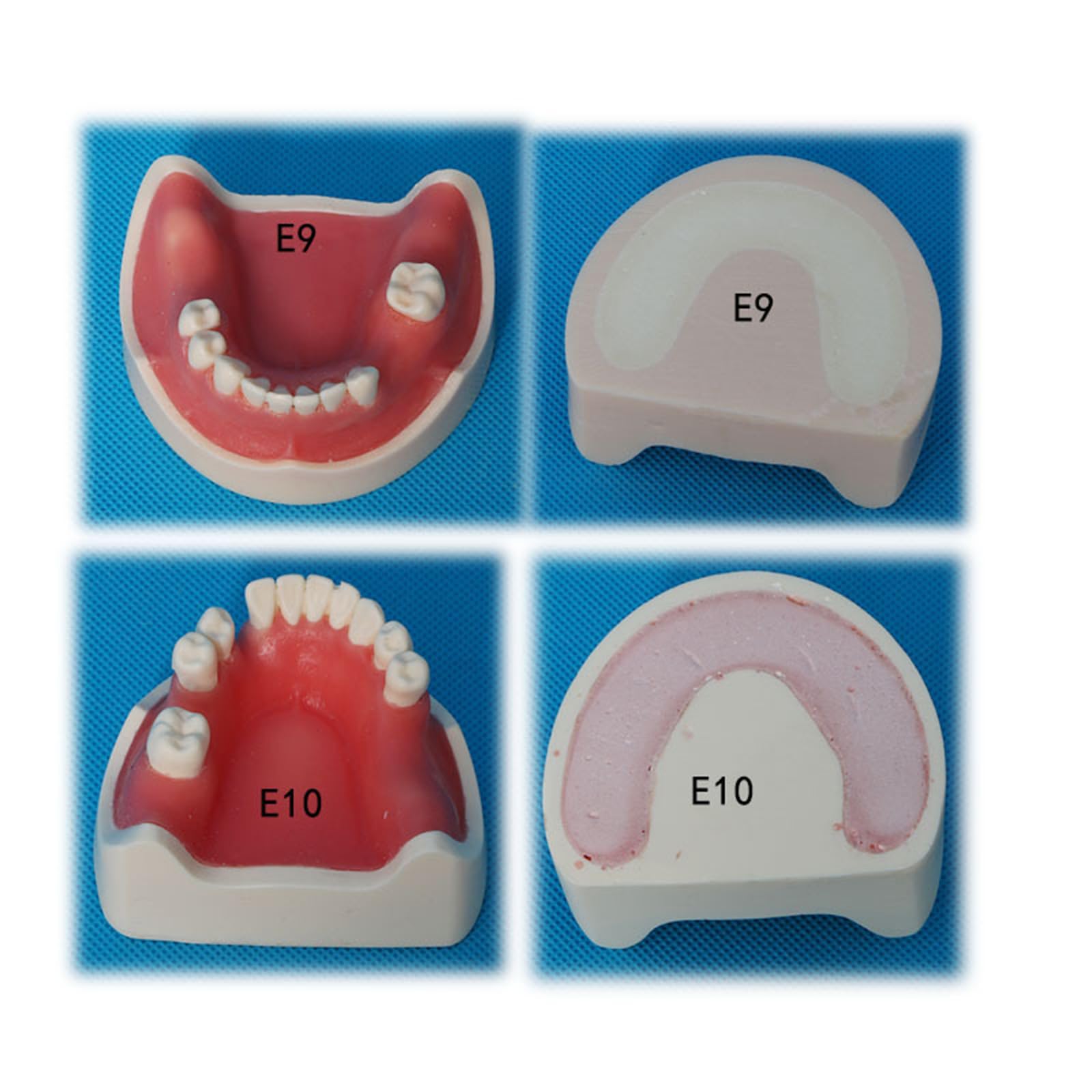 Modello di impianto Dentale - Modello di impianto mandibolare Medico e odontoiatrico - per Studio didattico Displaymedical Model,A5-8cm