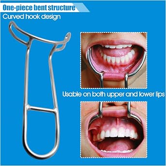 Dental Cheek Retractor, Orthodontic Lip and Cheek Retractor, Intraoral Mouth Opening Tool for Clinic, Teeth Whitening, Oral Examination and Photography, 2 Pack