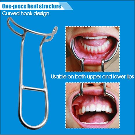 Dental Cheek Retractor, Orthodontic Lip and Cheek Retractor, Intraoral Mouth Opening Tool for Clinic, Teeth Whitening, Oral Examination and Photography, 2 Pack