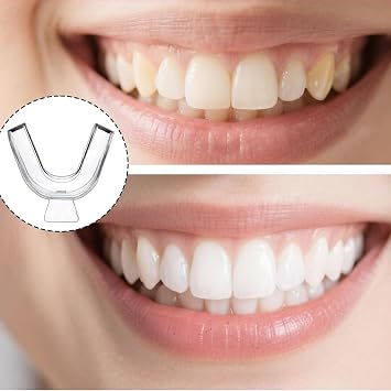 4PCS Dental Trays for Whitening Teeth Thermoplastic Teeth Whitening Mouth Trays Tooth Mouth Guard Whitening Teeth Trays with Case Mouth Guard Care Oral Hygiene Tooth Tool