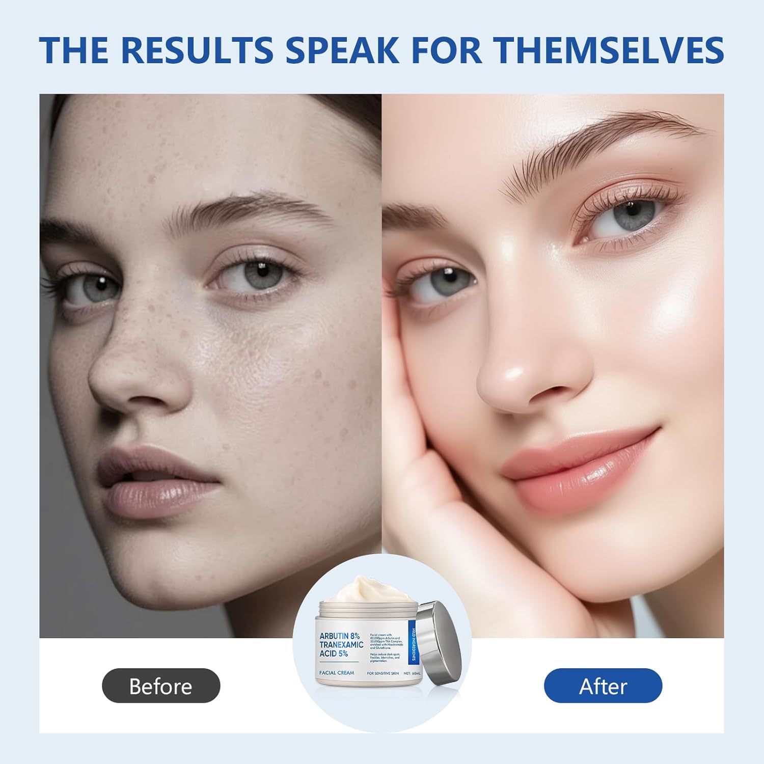 Richie House 8% Arbutin + 5% Tranexamic Acid Cream - 80,000ppm Brightening Treatment with Niacinamide & Glutathione for Dark Spots, Pigmentation & Melasma - 60ml - Image 7