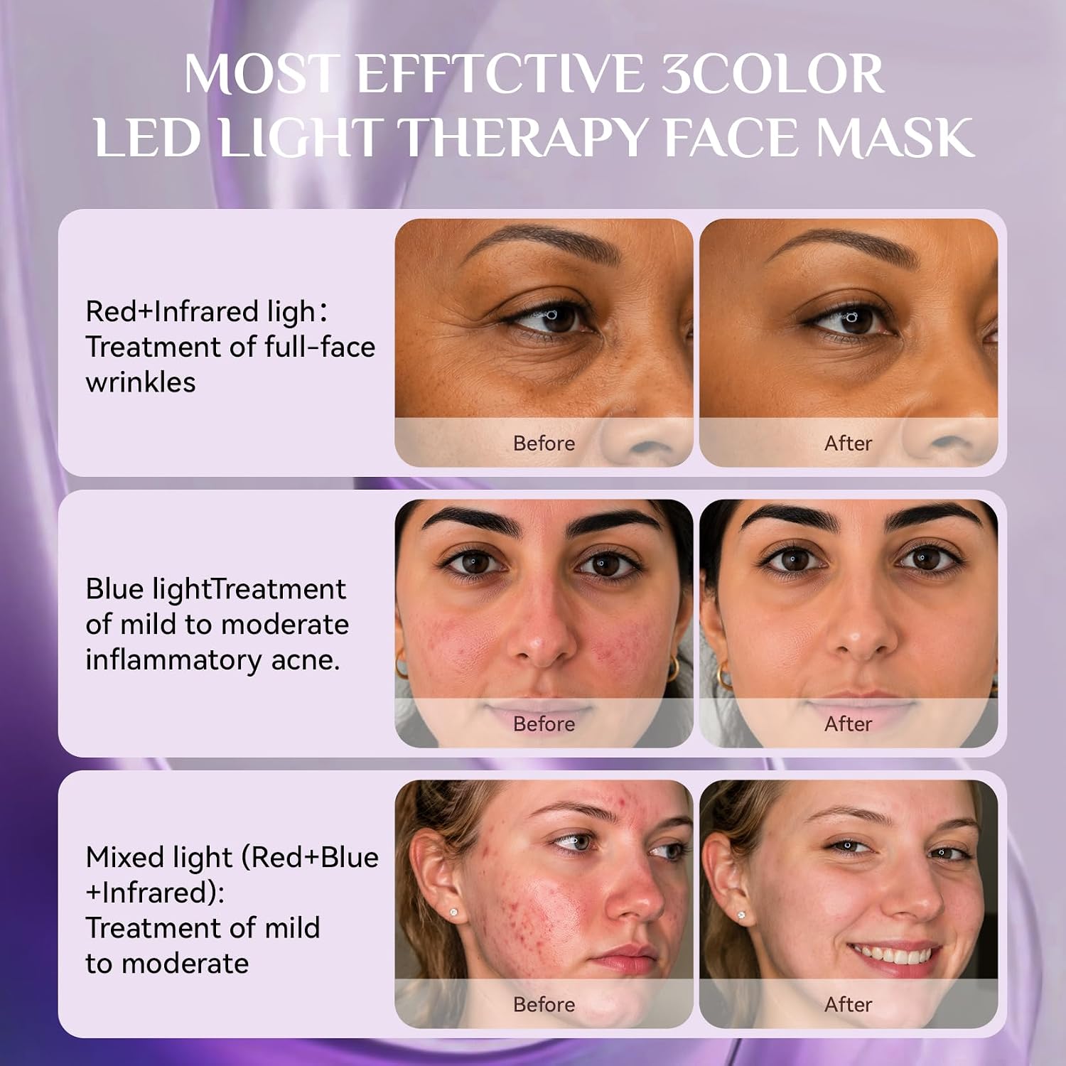 FOLOKE Red Light Therapy Face Mask for Wrinkles and Acne Treatment image 3