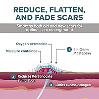 Vista 4 de Epi-Derm Mastopexy Anchor Shape Silicone Scar Tape – Tailored for Breast Reduction Recovery - Anchor Design for Precise Fit - Helps Smooth & Fade